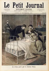 Doktor Roux által meggyógyított csonk, illusztráció a „Le Petit Journal”-ból, 1894. szeptember 24.